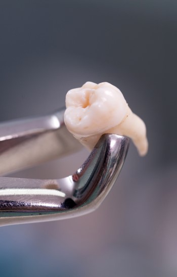 Dental equipment holding an extracted tooth